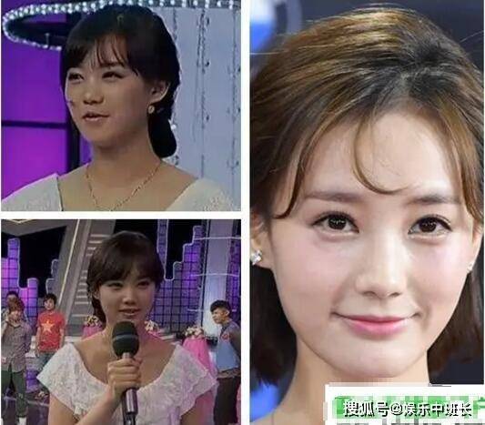 李一桐整容呀对比前后